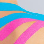 Close up of patients shoulder with applied pink and blue kinesio tape in bright office